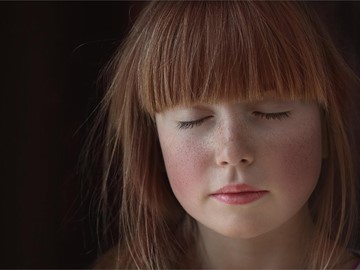 ¿Qué es la rosácea? Causas y síntomas